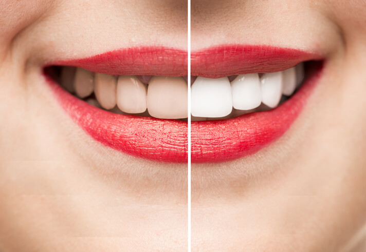 Propaganda em odontologia antes e depois